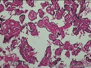 胎盘组织图30