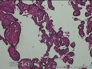 胎盘组织图13