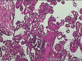 胎盘组织图18