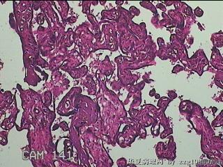 胎盘组织图7