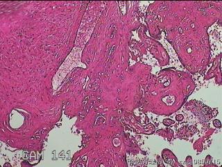 胎盘组织图36