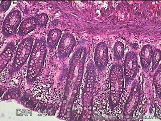 直乙结肠粘膜图11