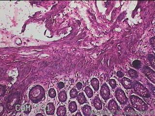 直乙结肠粘膜图19