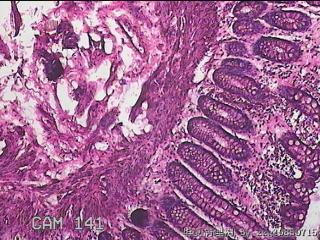 直乙结肠粘膜图16