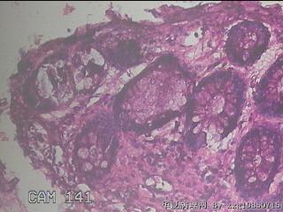 直乙结肠粘膜图37
