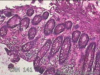 直乙结肠粘膜图10