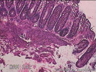 直乙结肠粘膜图4
