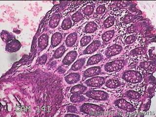 直乙结肠粘膜图15