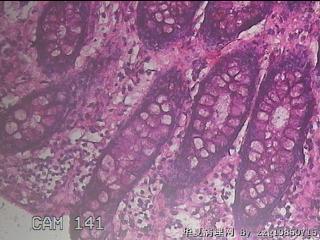 直乙结肠粘膜图32