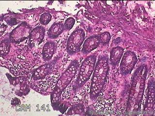 直乙结肠粘膜图7