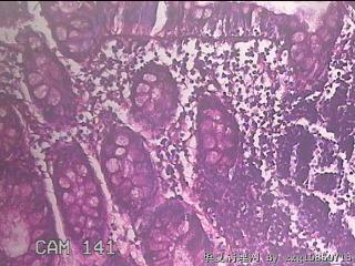 直乙结肠粘膜图34