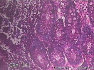 直乙结肠粘膜图33
