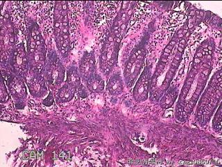 直乙结肠粘膜图5
