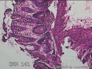 直乙结肠粘膜图20