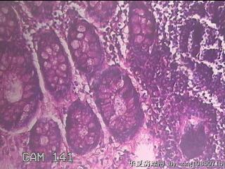 直乙结肠粘膜图35