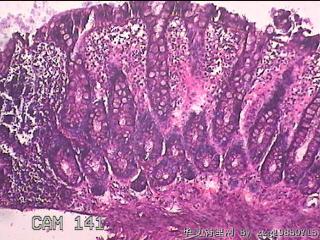 直乙结肠粘膜图8