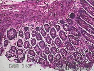 直乙结肠粘膜图17