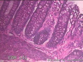 直乙结肠粘膜图23