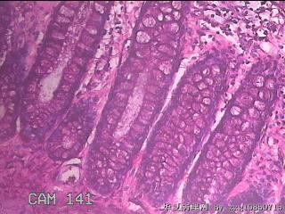 直乙结肠粘膜图27