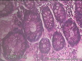 直乙结肠粘膜图38