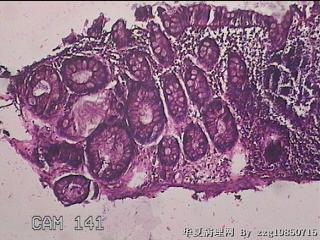 直乙结肠粘膜图9