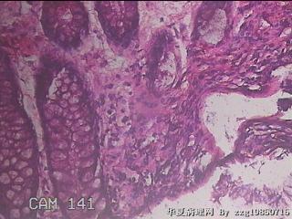 直乙结肠粘膜图24