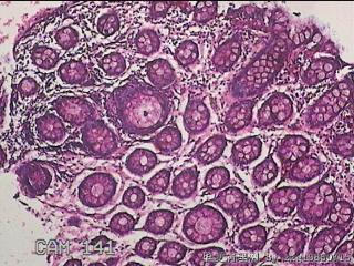 直乙结肠粘膜图14