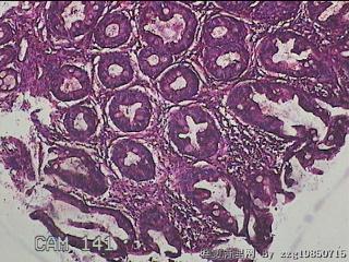 直乙结肠粘膜图12