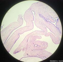 子宫内膜图9