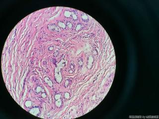 胆囊壁层可见大量腺体图3