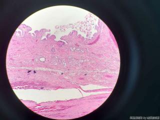 胆囊壁层可见大量腺体图15
