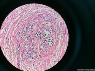 胆囊壁层可见大量腺体图11