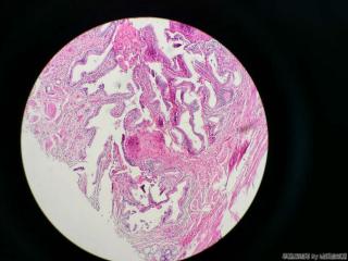 胆囊壁层可见大量腺体图7