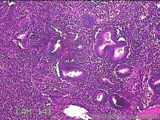 宫腔内组织图35