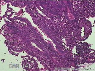 宫腔内组织图27
