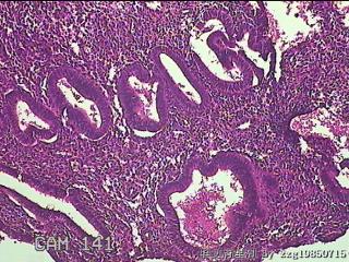 宫腔内组织图7