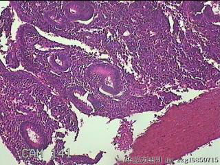 宫腔内组织图11