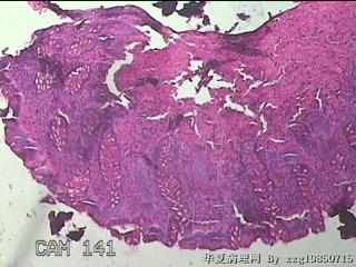 直肠粘膜图5