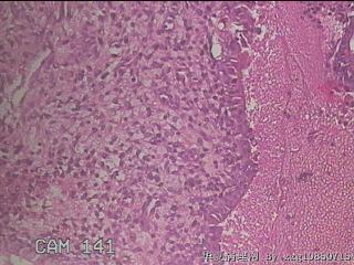 宫颈内容物组织图39