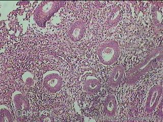 宫颈内容物组织图7