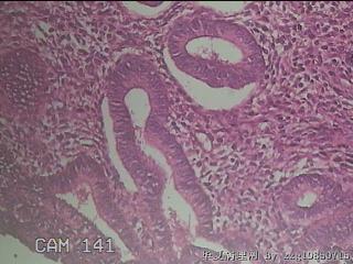 宫颈内容物组织图46