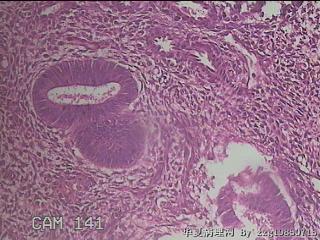 宫颈内容物组织图43