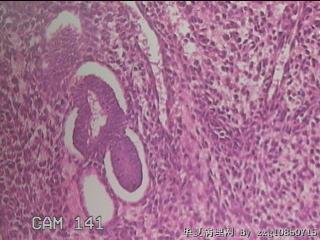宫颈内容物组织图48
