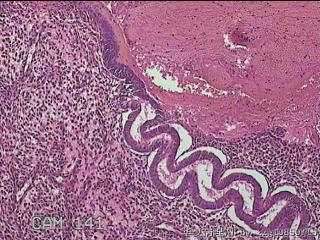 宫颈内容物组织图31