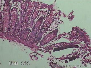 直乙结肠粘膜图13