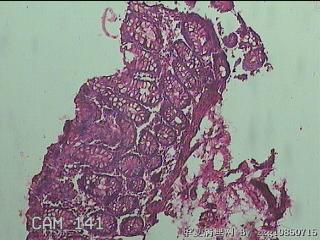 直乙结肠粘膜图15