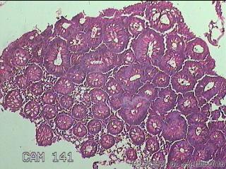 直乙结肠粘膜图9