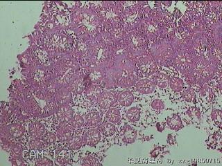 直乙结肠粘膜图17