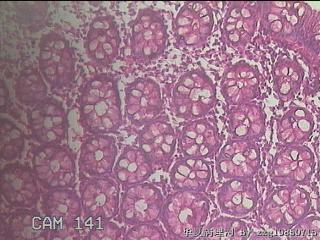 直乙结肠粘膜图36