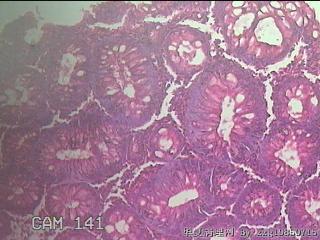 直乙结肠粘膜图32